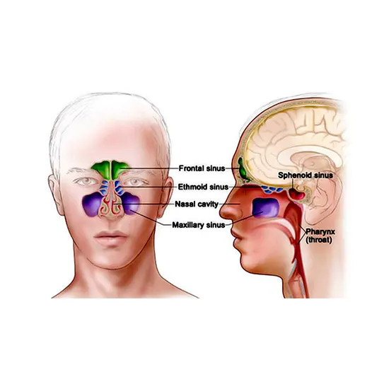 Paranasal Sinus and Nasal Cavity Cancer